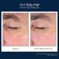 Skinbetter Science - EyeMax AlphaRet Overnight - BESTSKINWITHIN