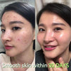 SOME BY MI AHA BHA PHA 30 DAYS MIRACLE SERUM - BESTSKINWITHIN